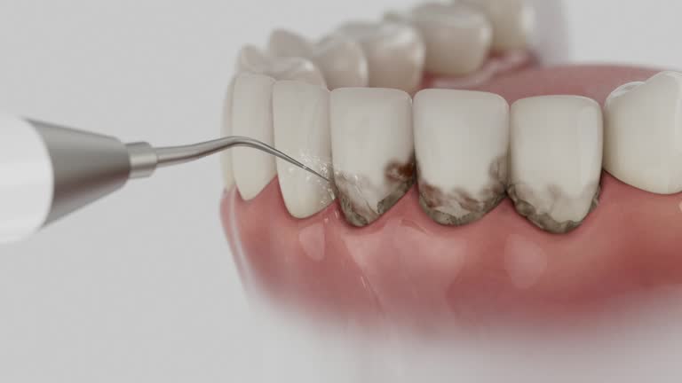 Reliable Wisdom Tooth Removal contractor in San Joaquin County County, CA by Dentist Open Now